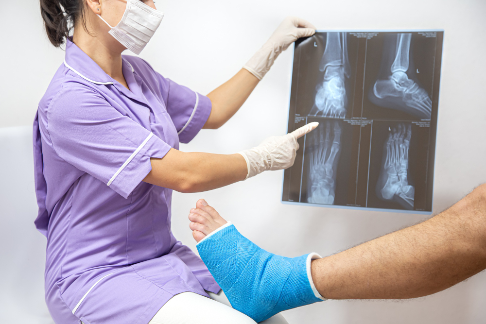 Understanding Fractures & Injuries